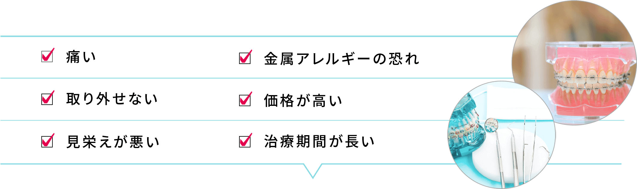 痛い 金属アレルギーの恐れ 取り外せない 価格が高い 見栄えが悪い 治療期間が長い
