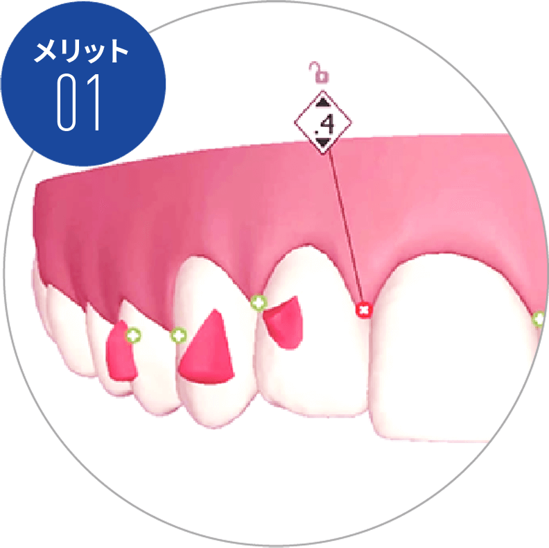 メリット01