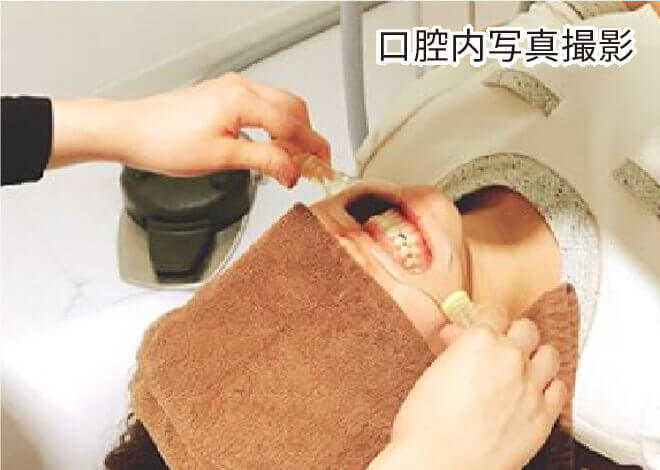 口腔内写真撮影