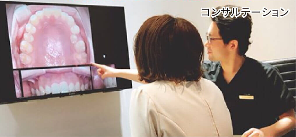 コンサルテーション