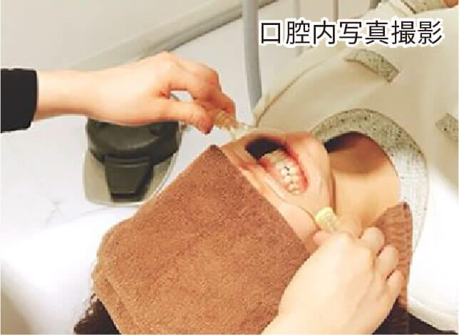 口腔内写真撮影