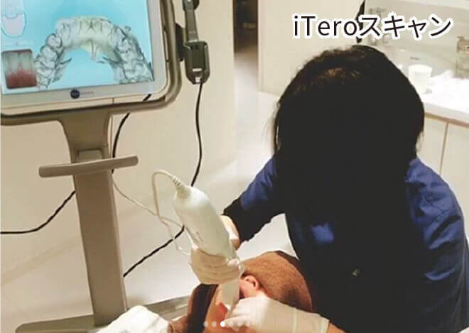 iTeroスキャン
